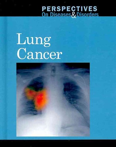 Cover for Jacqueline Langwith · Lung Cancer (Hardcover Book) (2010)