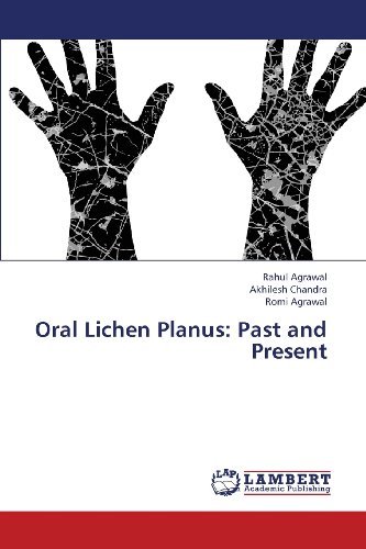 Cover for Romi Agrawal · Oral Lichen Planus: Past and Present (Pocketbok) (2013)