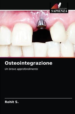 Cover for Rohit S · Osteointegrazione (Paperback Book) (2021)