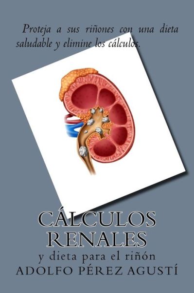 Cover for Adolfo Perez Agusti · Calculos renales (Paperback Book) (2017)