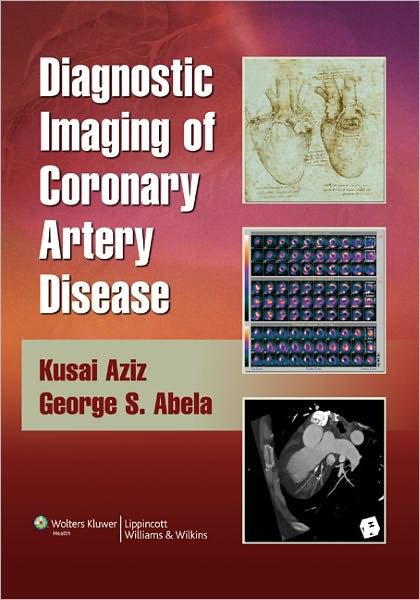 Cover for Diagnostic Imaging of Coronary Artery Disease (Hardcover Book) (2008)