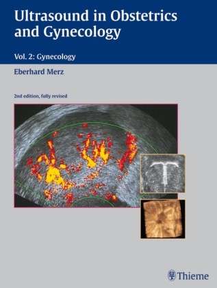 Cover for Eberhard Merz · Ultrasound in Obstetrics and Gynecology: Volume 2: Gynecology (Inbunden Bok) [2nd edition, fully revised edition] (2006)