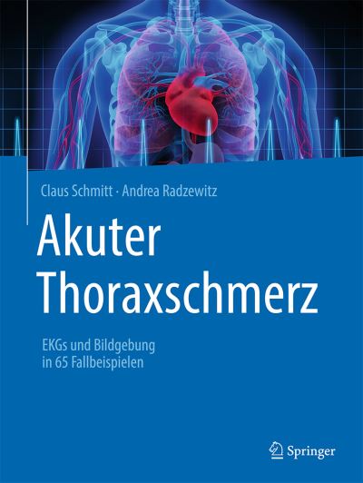 Akuter Thoraxschmerz - Schmitt - Książki -  - 9783662624029 - 5 lipca 2022