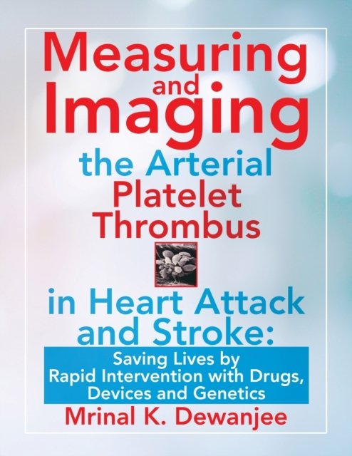 Cover for Mrinal K Dewanjee · Measuring and Imaging the Arterial Platelet Thrombus in Heart Attack and Stroke (Paperback Book) (2021)