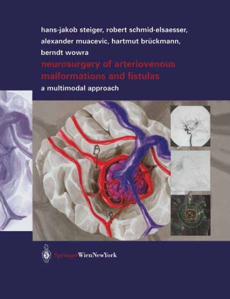 Cover for Robert Schmid-Elsaesser · Neurosurgery of Arteriovenous Malformations and Fistulas: A Multimodal Approach (Hardcover Book) [2002 edition] (2002)