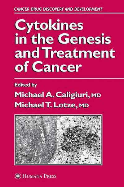 Cover for Michael a Caligiuri · Cytokines in the Genesis and Treatment of Cancer - Cancer Drug Discovery and Development (Paperback Book) [Softcover reprint of hardcover 1st ed. 2007 edition] (2010)