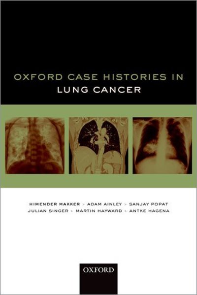 Cover for Makker, Himender K. (Consultant Respiratory Physician, Consultant Respiratory Physician, North Middlesex University Hospital NHS Trust, London, UK) · Oxford Case Histories in Lung Cancer - Oxford Case Histories (Paperback Book) (2018)