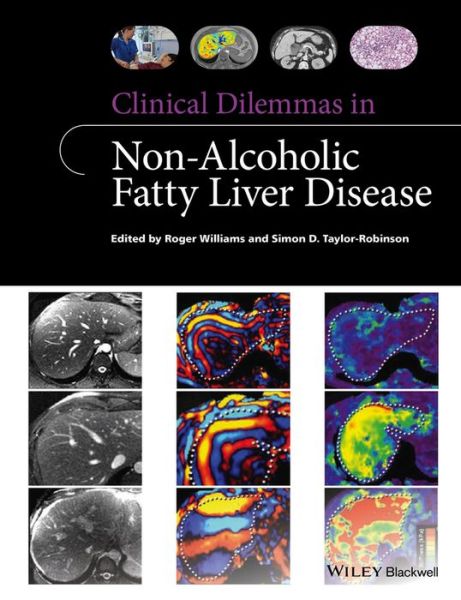 Clinical Dilemmas in Non-Alcoholic Fatty Liver Disease - Clinical Dilemmas (UK) - Roger Williams - Bøker - John Wiley and Sons Ltd - 9781118912034 - 29. april 2016