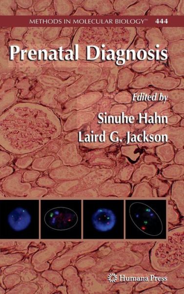 Cover for Sinuhe Hahn · Prenatal Diagnosis - Methods in Molecular Biology (Hardcover Book) [2008 edition] (2008)