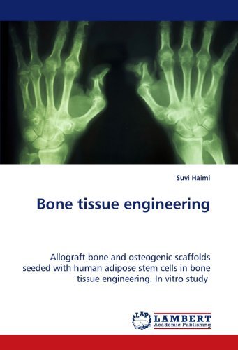 Cover for Suvi Haimi · Bone Tissue Engineering: Allograft Bone and Osteogenic Scaffolds Seeded with Human Adipose Stem Cells in Bone Tissue Engineering. in Vitro Study (Taschenbuch) (2009)