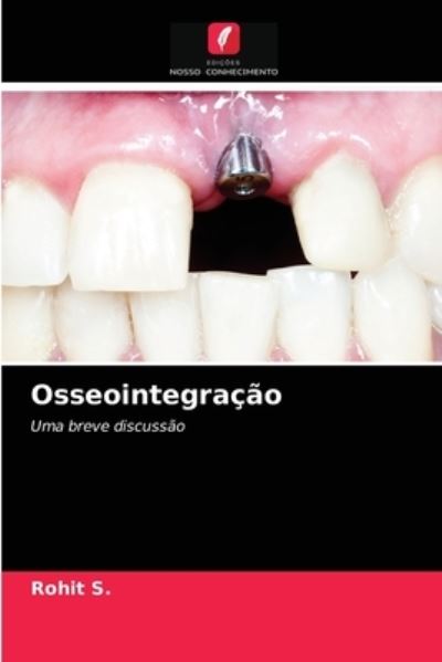 Osseointegracao - Rohit S - Livros - Edicoes Nosso Conhecimento - 9786203987034 - 3 de agosto de 2021