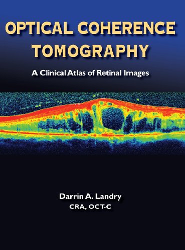 Cover for A. Landry Darrin · Optical Coherence Tomography (Hardcover Book) (2013)