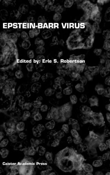 Cover for Epstein-barr Virus (Hardcover Book) (2005)