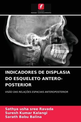 Cover for Sathya Usha Sree Ravada · Indicadores de Displasia Do Esqueleto Antero-Posterior (Paperback Book) (2021)