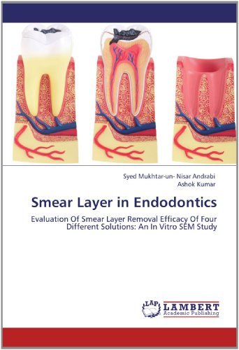 Cover for Ashok Kumar · Smear Layer in Endodontics: Evaluation of Smear Layer Removal Efficacy of Four Different Solutions: an in Vitro Sem Study (Paperback Bog) (2012)