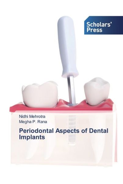 Cover for Nidhi Mehrotra · Periodontal Aspects of Dental Implants (Paperback Bog) (2019)