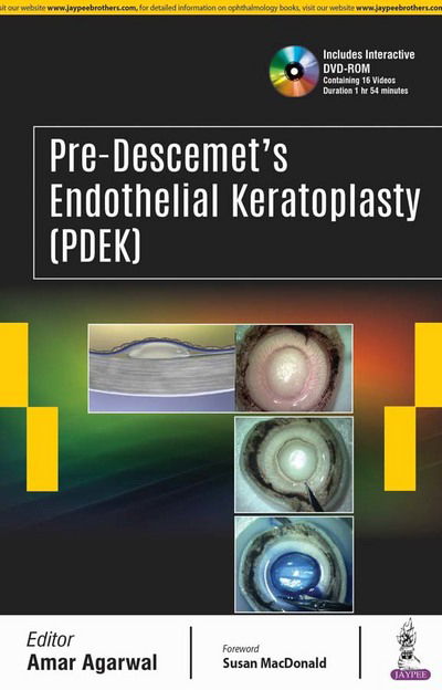 Cover for Amar Agarwal · Pre-Descemet’s Endothelial Keratoplasty (PDEK) (Hardcover Book) (2017)