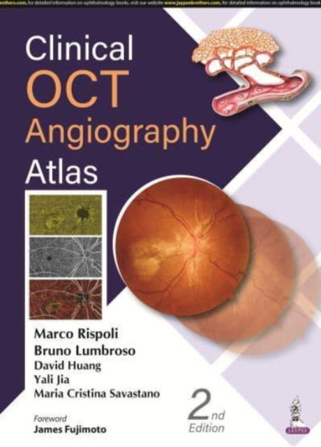 Cover for Marco Rispoli · Clinical OCT Angiography Atlas (Hardcover Book) [2 Revised edition] (2021)