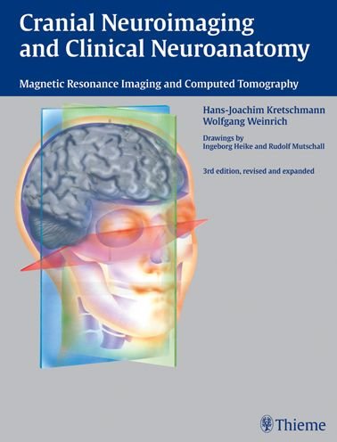 Cover for Hans-Joachim Kretschmann · Cranial Neuroimaging and Clinical Neuroanatomy (Book) (2003)