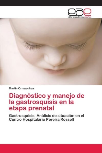 Cover for Ormaechea · Diagnóstico y manejo de la ga (Bok) (2018)