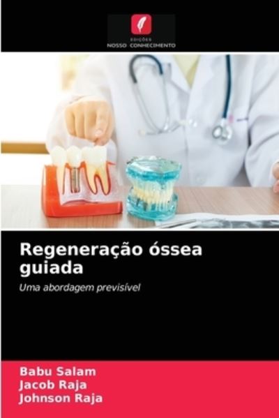 Regeneracao ossea guiada - Babu Salam - Books - Edições Nosso Conhecimento - 9786203481037 - March 14, 2021