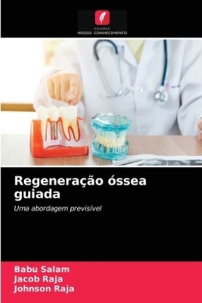 Cover for Babu Salam · Regeneracao ossea guiada (Paperback Bog) (2021)