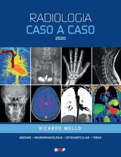 Cover for Ricardo Mello · Radiologia Caso a Caso 2020 (Paperback Book) (2020)