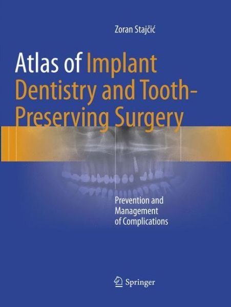 Atlas of Implant Dentistry and Tooth-Preserving Surgery: Prevention and Management of Complications - Zoran Stajcic - Böcker - Springer International Publishing AG - 9783319825038 - 8 maj 2018