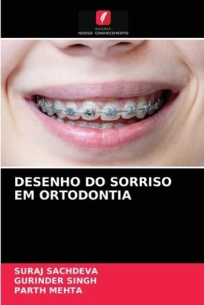 Cover for Suraj Sachdeva · Desenho Do Sorriso Em Ortodontia (Paperback Book) (2021)