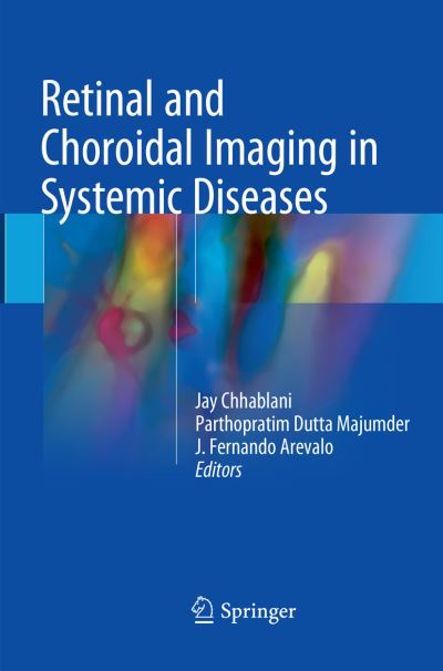 Retinal and Choroidal Imaging in Systemic Diseases - - Books - Springer Verlag, Singapore - 9789811354038 - December 28, 2018