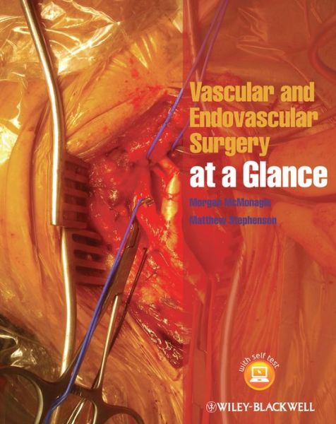 Cover for McMonagle, Morgan (HSE South Hospital Group and the Royal College of Surgeons in Ireland) · Vascular and Endovascular Surgery at a Glance - At a Glance (Paperback Book) (2014)