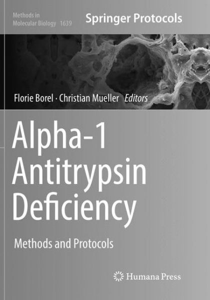 Cover for Alpha 1 Antitrypsin Deficiency (Book) [Softcover reprint of the original 1st ed. 2017 edition] (2018)