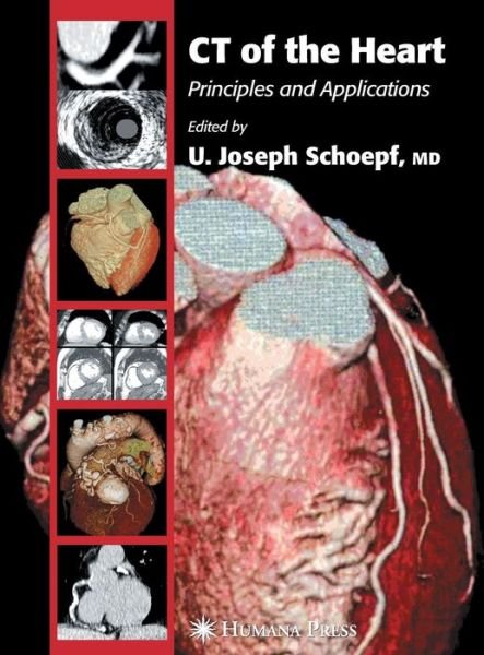 Cover for U Joseph Schoepf · Ct of the Heart: Principles and Applications (Hardcover bog) (2004)