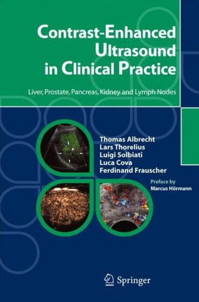 Cover for Thomas Albrecht · Contrast-Enhanced Ultrasound in Clinical Practice: Liver, Prostate, Pancreas, Kidney and Lymph Nodes (Paperback Book) [2005 edition] (2005)