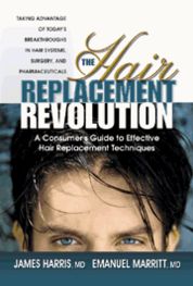 Cover for James Harris · The Hair Replacement Revolution: a Consumers Guide to Effective Hair Replacement Techniques (Paperback Book) (2003)