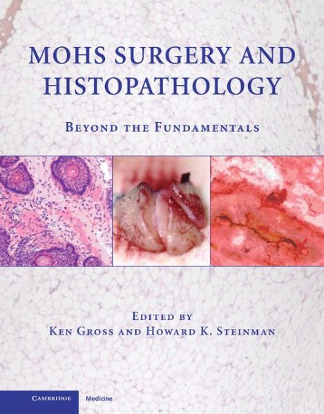 Cover for Ken Gross · Mohs Surgery and Histopathology: Beyond the Fundamentals (Hardcover Book) (2009)