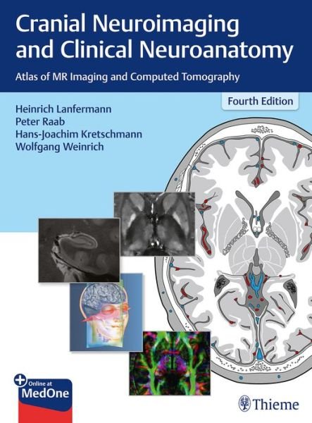 Cranial Neuroimaging and Clinical Neuroanatomy: Atlas of MR Imaging and Computed Tomography - Hans-Joachim Kretschmann - Kirjat - Thieme Publishing Group - 9783136726044 - keskiviikko 9. tammikuuta 2019