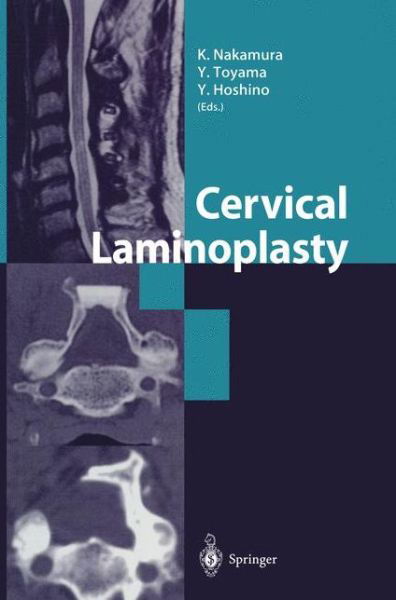 Cervical Laminoplasty - Yuichi Hoshino - Books - Springer Verlag, Japan - 9784431703044 - July 24, 2003