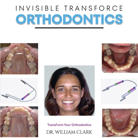 Dr. William Clark · Invisible TransForce Orthodontics (Hardcover bog) (2024)