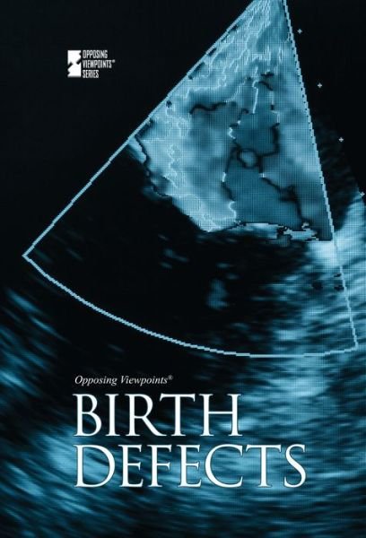 Cover for Gale · Birth Defects (Hardcover bog) (2014)