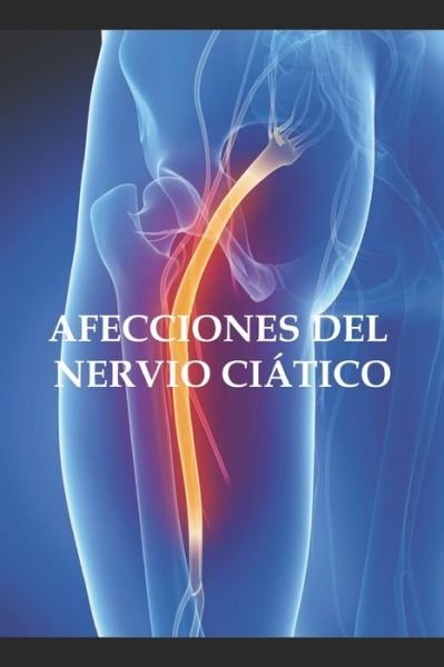Cover for Adolfo Perez Agusti · Afecciones del nervio ciatico (Paperback Book) (2020)