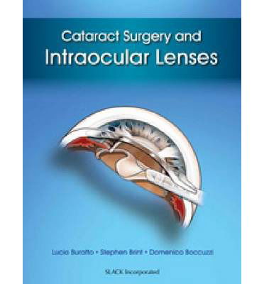 Cover for Lucio Buratto · Cataract Surgery and Intraocular Lenses (Hardcover Book) (2014)