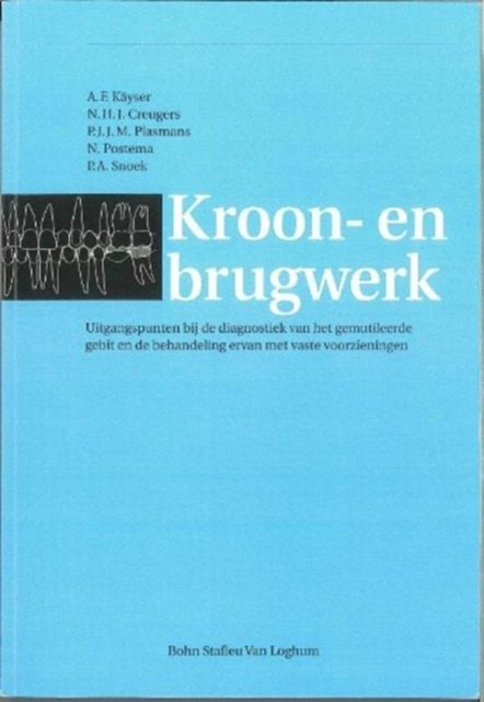 Cover for Peter Gijsbers · Kroon- en brugwerk: Uitgangspunten bij de diagnostiek van het gemutileerde gebit en de behandeling ervan met vaste voorzieningen (Paperback Bog) (2006)