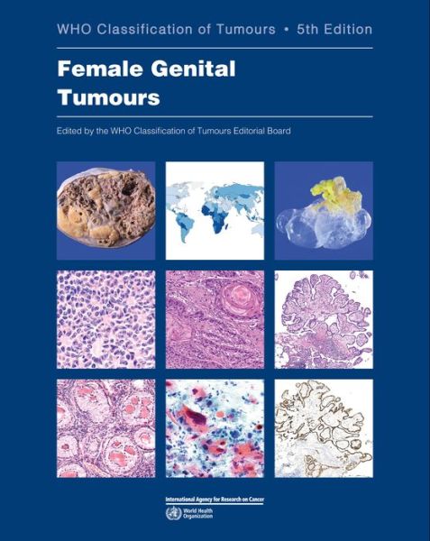 Cover for International Agency for Research on Cancer · WHO classification of female genital tumours (Paperback Book) (2020)