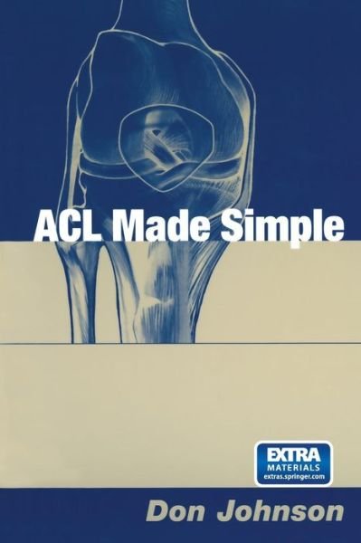 Cover for Don Johnson · ACL Made Simple (Pocketbok) [Softcover reprint of the original 1st ed. 2004 edition] (2013)