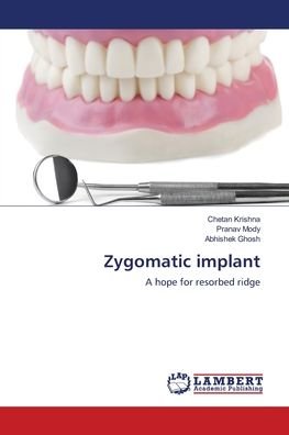 Cover for Krishna · Zygomatic implant (Buch) (2018)