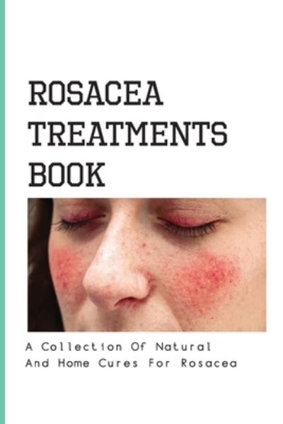 Cover for Merlin Diskind · Rosacea Treatments Book- A Collection Of Natural And Home Cures For Rosacea (Paperback Book) (2020)