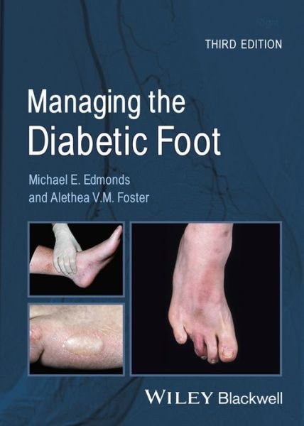 Cover for Edmonds, Michael E. (King's College, University of London, UK) · Managing the Diabetic Foot (Paperback Bog) (2014)