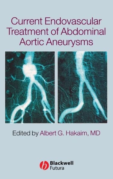 Cover for AG Hakaim · Current Endovascular Treatment of Abdominal Aortic Aneurysms (Innbunden bok) (2005)