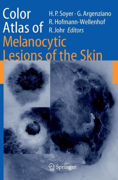 Cover for H Peter Soyer · Color Atlas of Melanocytic Lesions of the Skin (Hardcover Book) [2007 edition] (2007)